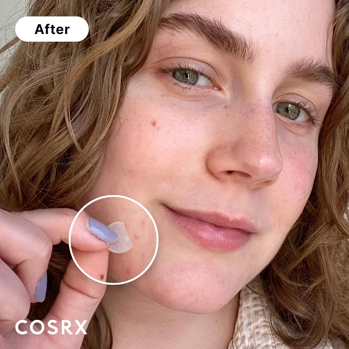 Cosrx Acne Pimple Patch Absorbing Hydrocolloid Original 3 Sizeize Patches For Blemishes And Zits Cover, Sizepot Sizetickers For Face And Body, Not Tested On Animals, No Toxic Ingredients (240 Count (Pack.