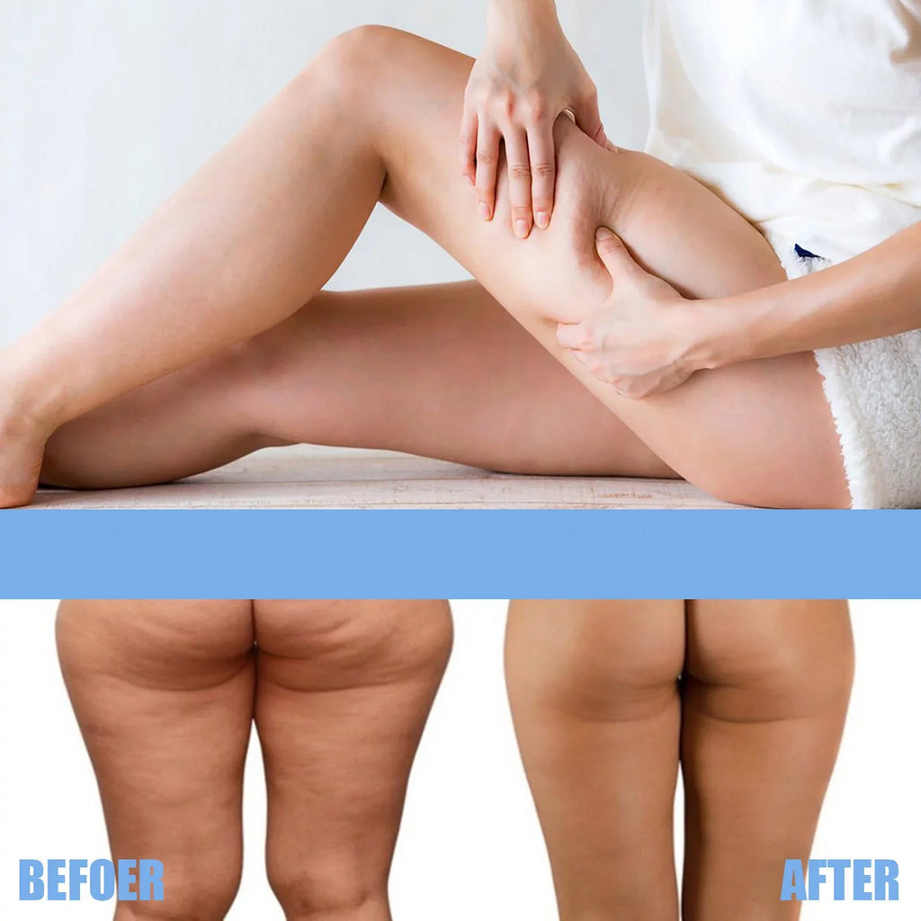 Collagen Essence Tightening Patch, Eelhoe Thigh Lift Tape, Lazy Thigh Sizeculpting Patch